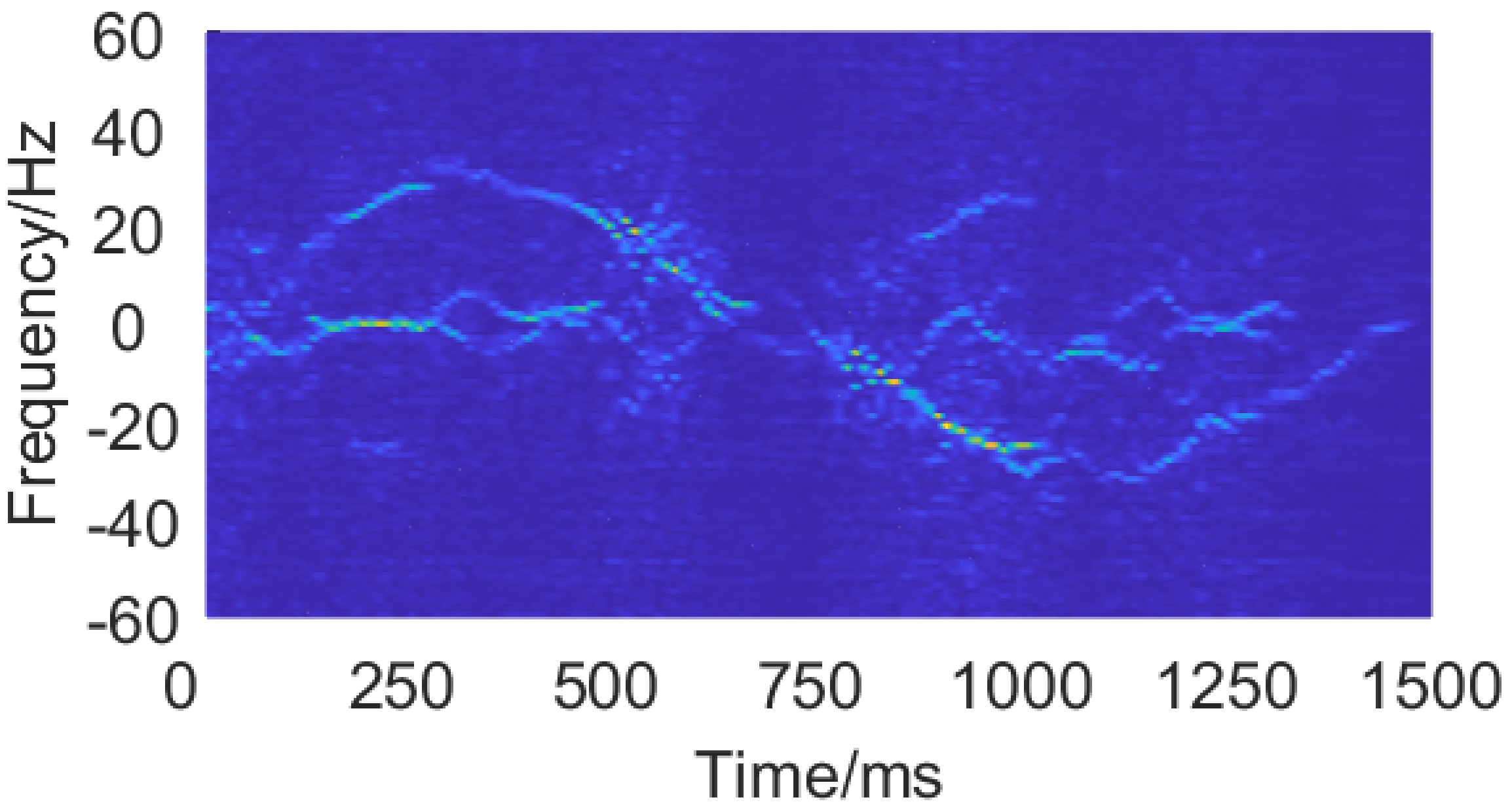 The enhanced spectrogram from the SEN of a pushing and pulling gesture.